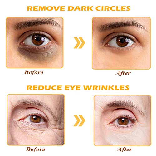 24K Gold Eye Mask, 30 Pairs Under Eye Masks for Dark Circles and Puffiness Treatment, Under Eye Patches for Puffy Eyes and Eye Bags, Gel Eye Mask Eye Pads for Face Skin Care