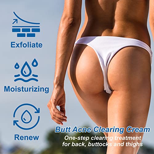 MO TULIP Butt Acne Clearing Treatment, Bum Acne Treatment, Clearing Acne, Pimples, Zits, Razor Bumps for Buttocks and Thigh Area. Recur acne skin, balance sebum and moisture (3.4o.z) (1PCS)