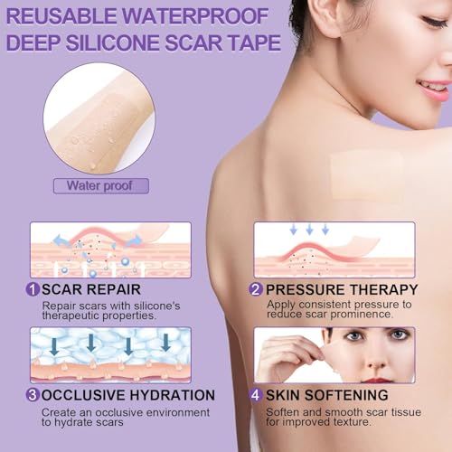 Silicone Scar Sheets, Medical Grade Silicone Scar Tape (1.6" x 120"), Professional Scar Removal Treatment, Reusable, for Healing Keloids, Surgeries Scars, C-sections, and Burns