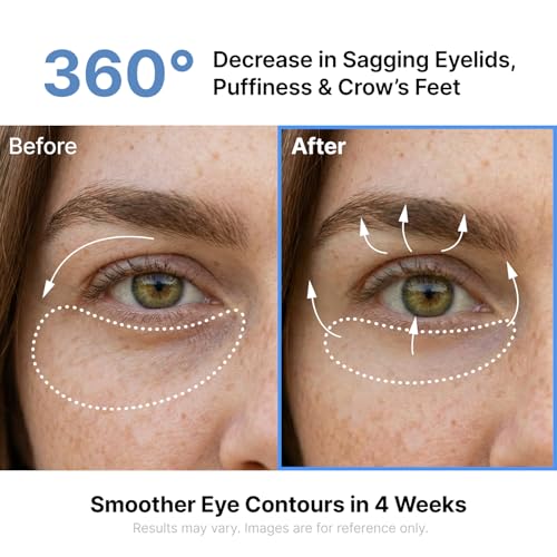 Silk Peptides EGF Eye Cream – Puffiness & Fine Lines
