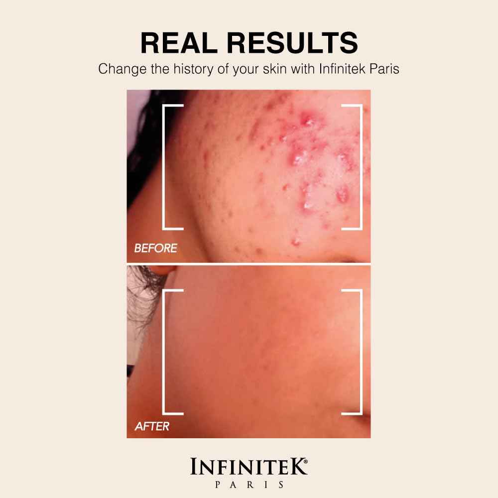 Infinitek Paris Retinol Face Moisturizer Night Cream - Premium Skin Care with Collagen & Vitamin E. Advanced Anti-Aging and Antioxidant Face Cream. Vitamin Enriched Moisturizer for Radiant Skin