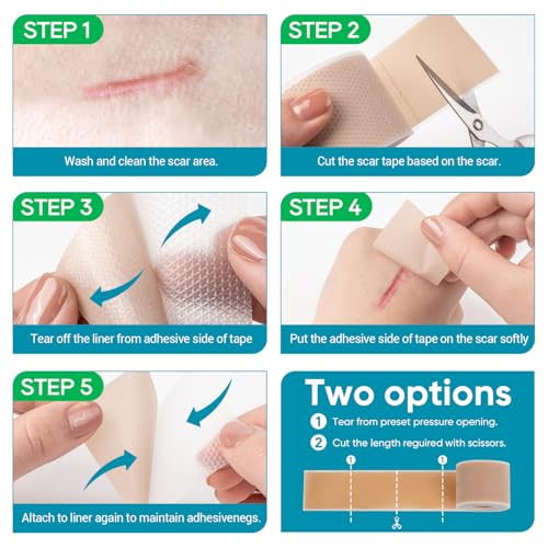 Silicone Scar Tape, Silicone Scar Sheets for Surgical Scars (1.6"x 80" Roll-2M), Medical Ggrade Scar Tape for Scars, Keloid, Acne Scars, Burn, C-Section, Stretch Marks Scars Away