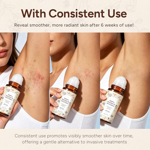Cyperus Rotundus Oil Roll-On - Natural Hair Reduction Serum 2.02oz