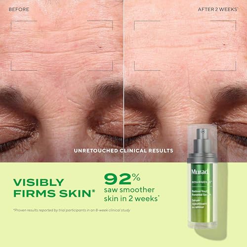 Murad Top 3 Derm-Recommended Actives - 3-Piece Trial Kit ($61 Value) - Daily Skincare Regimen - Ess-C Cleanser 2Fl Oz, Retinol Serum 0.33Fl Oz, Hydro Dynamic Moisturizer 0.25Fl Oz