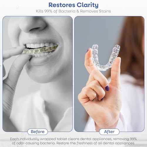 Dr. Taylor¡¯s Denture and Retainer Cleaner Tablets (120 count) Effectively Removes Stains, Plaque, and Odor - Sports guards, Night Guards, Clear Aligners & Dentures Refreshing Mint Flavor