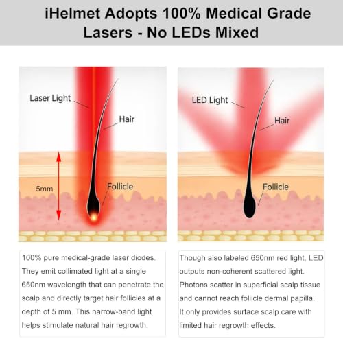 iHelmet Laser Hair Growth System - FDA Cleared Red Light Therapy Helmet for Hair Regrowth