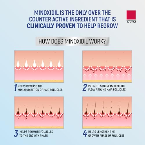 Minoxidil 5% Foam Hair Regrowth Treatment for Men, 3-Month Supply