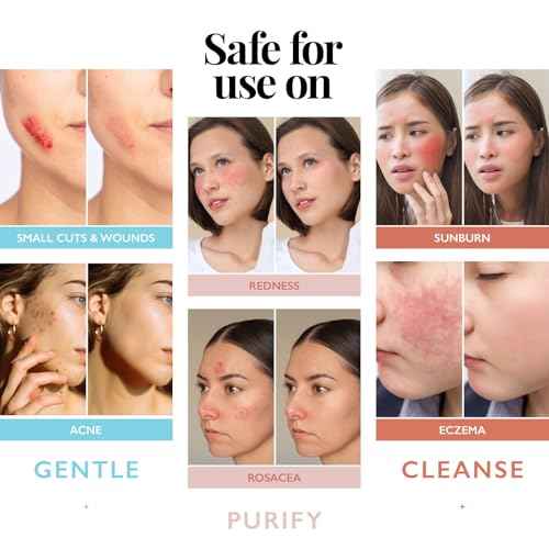 Hypochlorous Acid Spray for Face and Skin | Piercing Aftercare Spray | 8 oz Hypochlorous Acid Sprays for Face, Skin, Acne, Eczema, Body Acne Sprays, Piercing Aftercare, Facial Wound Solution, Workout