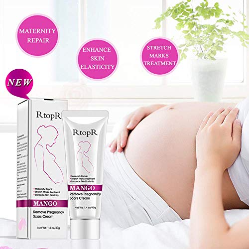 Mango Stretch Mark & Scar Removal Cream 40g