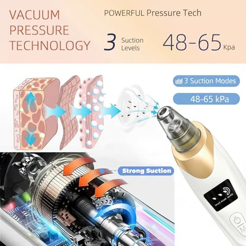Echtur Electric Blackhead Remover with 5 Suction Heads