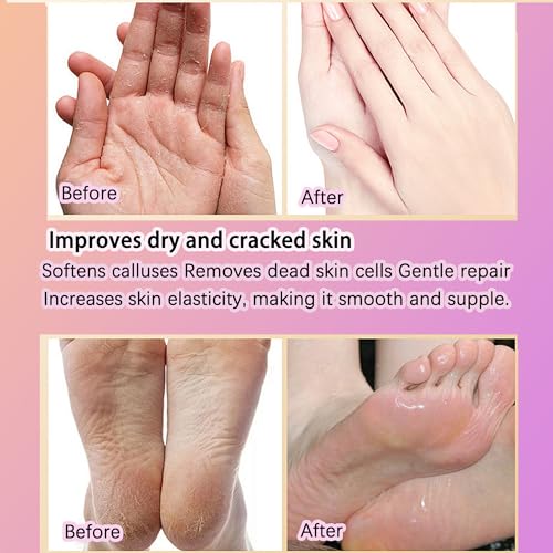 4 Pairs Paraffin Wax Gloves and Socks, Paraffin Wax for Hand and Feet, Paraffin Hand and Foot Gloves Booties for Intensive Hydration At Home Or Spa (peach)