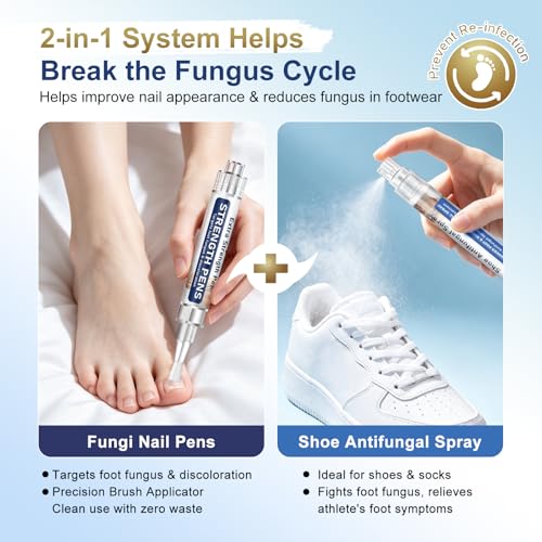 Toenail Fungus Treatment Pen Kit with Sanitizer - 25% Undecylenic Acid