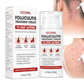 5% Benzoyl Peroxide Bump Cream for Scalp, Back & Body