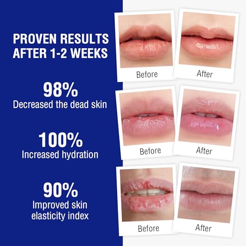 OUKEYA Lip Balm,0.25 Ounce,Medicated Lip Chapstick Medicated w/Beeswax,Petrolatum,Peppermint Oi,100% Natural Ingredients,Medicated Lip Moisturizer for Echapped Lips Treatment Severe 3 Packs