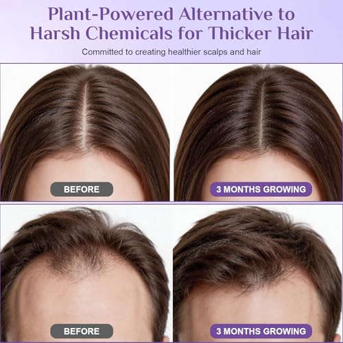 Rosemary Hair Growth Serum Roll-On | Biotin & Caffeine