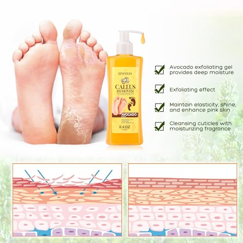 Professional Foot Callus Remover Gel Kit for Smooth Feet