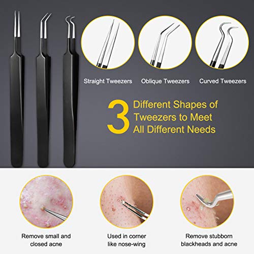 Blackhead Remover Tool Kit 10-Pc Stainless Steel Pimple Extractor