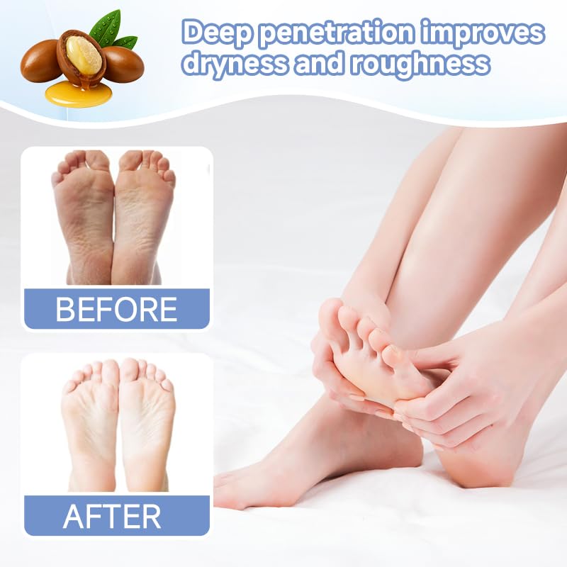 TrySafe PDRN & Collagen Foot Peel Mask for Dry Cracked Feet - 4 Pairs
