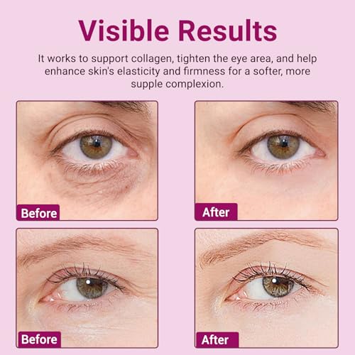 Calcium Volume Multi Balm Stick - Anti-Aging Collagen Cream for Intensive Hydration, Wrinkle Repair & Skin Firming, Suitable for Face, Eyes and Neck.