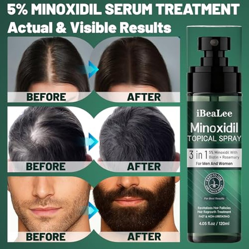 5% Minoxidil Hair Growth Spray for Men & Women