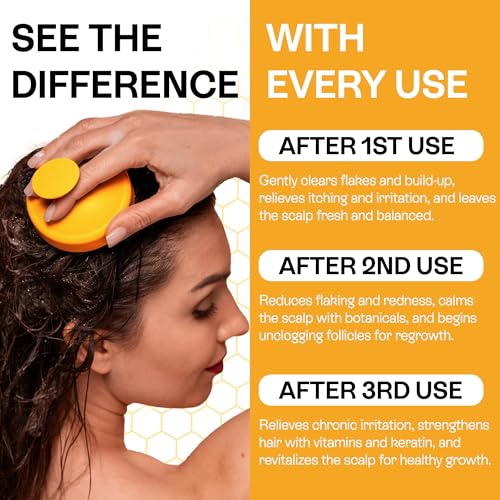 Psoriasis Shampoo for Dry Itchy Scalp with Salicylic Acid 3% - Eczema Relief & Folliculitis Treatment