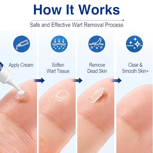 40% Salicylic Acid Wart Remover Cream - 1 oz