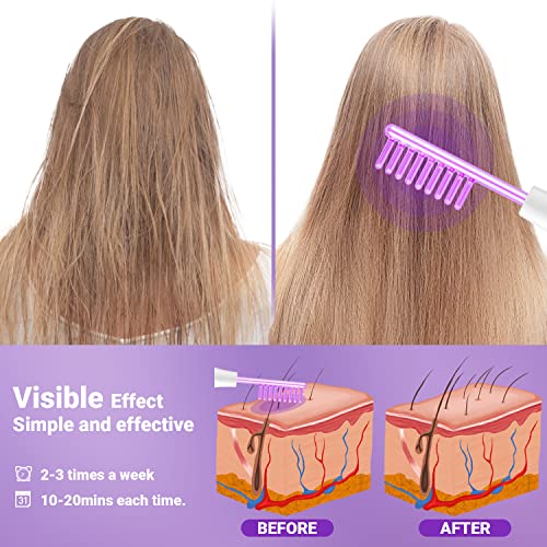 UUPAS High Frequency Facial Wand with 4 Violet Tubes