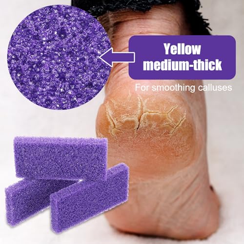 100pcs Exfoliating Pumice Stones for Callus Removal - Double-Sided Foot Scrubbers