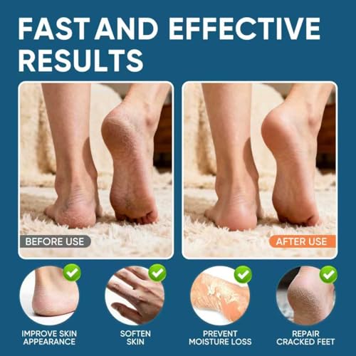 VREKEF Urea Cream 60% with 2% Salicylic Acid - Deep Hydration Foot Cream for Dry Cracked Heels & Calluses, 5.29 oz