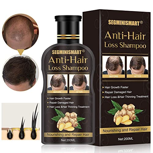 Hair Growth Shampoo,Anti-Hair Loss Shampoo,Hair Thickening Shampoo Helps Stop Loss, for Stronger, Thicker, Longer