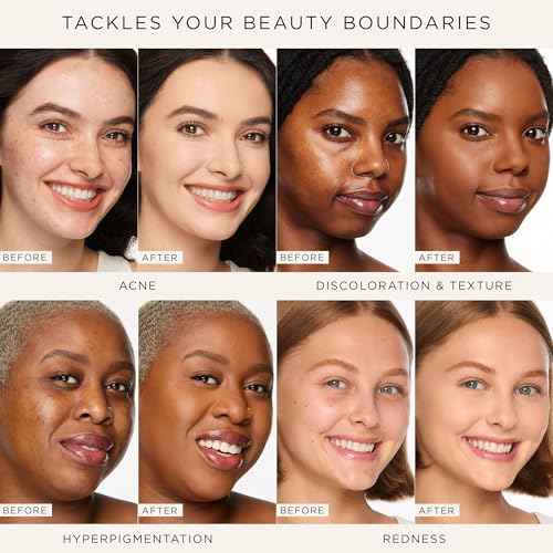 tarte shape tape concealer ? Full-Coverage, Matte Finish for Under Eye, Dark Circles, Fine Lines, Redness & Discoloration, Longwear, Dermatologist-Tested, Vegan, Cruelty-Free