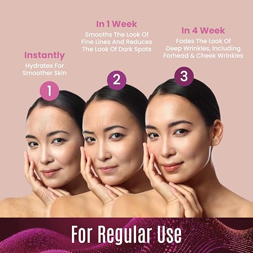 Retinol Cream ? 3% (Percent) Retinol Cream for Face with Hyaluronic Acid ? Anti-Aging Face Cream for Fine Lines and Wrinkles ? Hydrating Face Moisturizer with Shea Butter, Aloe Vera