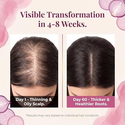 2 Pack Onion Biotin Rosemary Shampoo Bar for Hair Growth