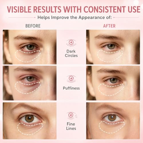 MyTend PDRN Eye Patches with Caffeine, Niacinamide & Peptides – Cooling Under Eye Gel Masks 60 pcs