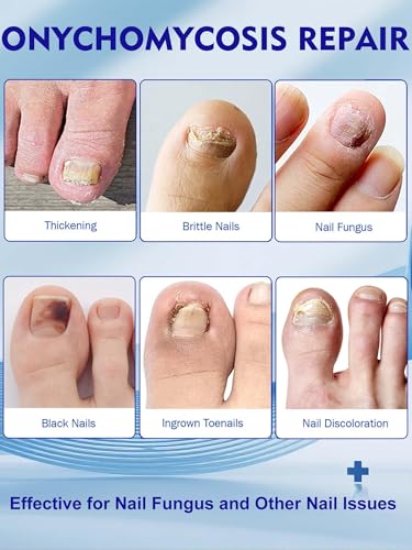 Extra Strength Overnight Nail Repair Patches for Damaged Nails - 48 Pack