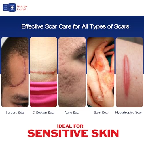 GauzeCare Silicone Scar Tape ? 1.6¡±x60¡± Roll ? Medical-Grade, Reusable, Professional Silicone Scar Tape for surgical scars, C-Section, Burns, Keloid, and Acne Scars