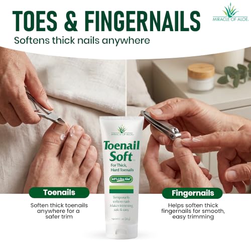Miracle of Aloe Toenail Softener Cream for Thick Hard Nails - 1 oz