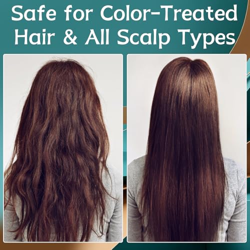 5% Minoxidil Hair Growth Cream for Men & Women - Anti Hair Loss Treatment with Biotin