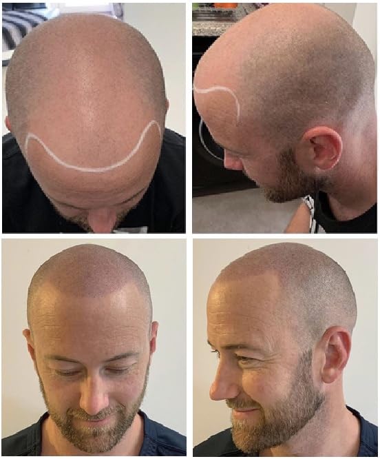 Nuva Scalp Micro-Pigmentation Ink Light Brown - SMP Pigment