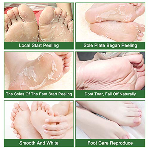 Liefiet Foot Peeling Mask Socks 5-Pack Tea Tree