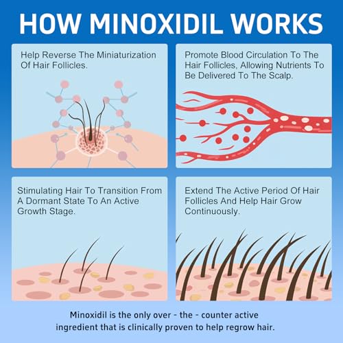 5% Minoxidil Hair Growth Serum for Men & Women, 4 Pack