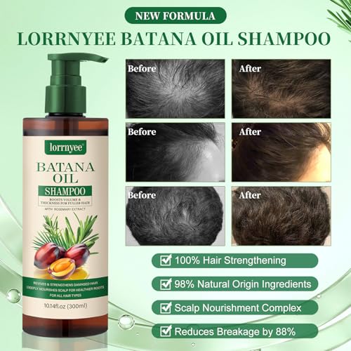 Batana Oil Hair Growth Shampoo for Thinning Hair Loss