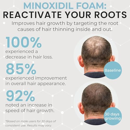 Remixidil Men's 5% Minoxidil Foam - Hair Regrowth Treatment