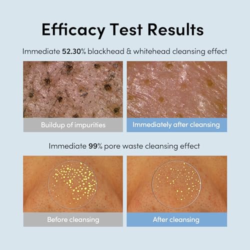 LAGOM Micro Pore Cleansing Oil – Blackhead Remover, 6.76 Fl Oz