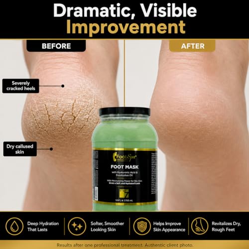 FootSpa Pedicure Recovery Mask - Hyaluronic Acid & Amino Acid, 1 Gallon