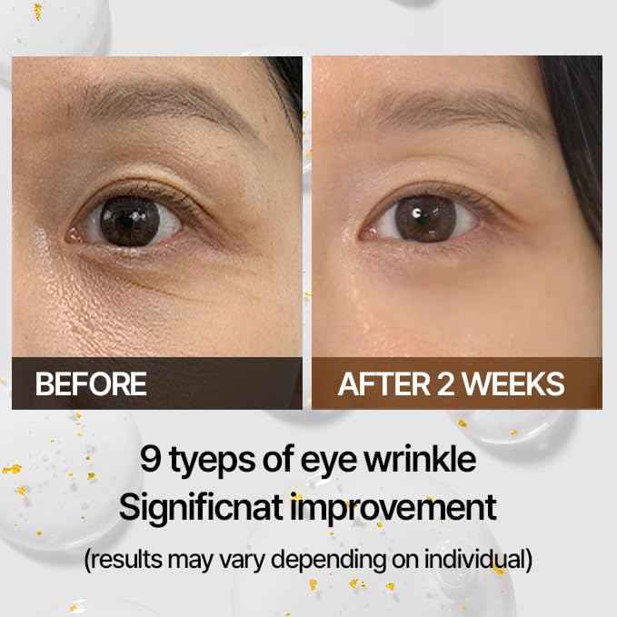 Wrinkle Argireline Serum – GLASS SKIN 14 Days Miracle Cellinto TOX 5D Shot – Korean Anti-Aging Serum with Matrixyl 3000, Collagen & Hyaluronic Acid – Smooths Fine Lines & Firms Skin – 0.47 oz