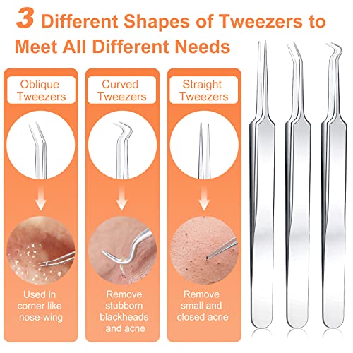 15 PCS Blackhead Remover Tool Kit | Professional Acne Extraction Set