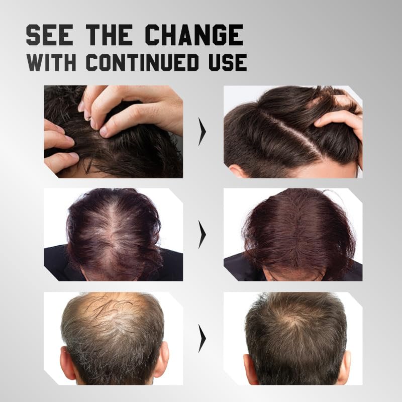 Hair Growth Spray for Thicker, Fuller Hair - Anti-Thinning Serum