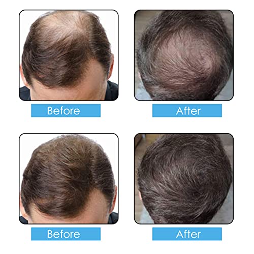 Hair Building Fibers Powder 100g - Instant Hair Loss Concealer