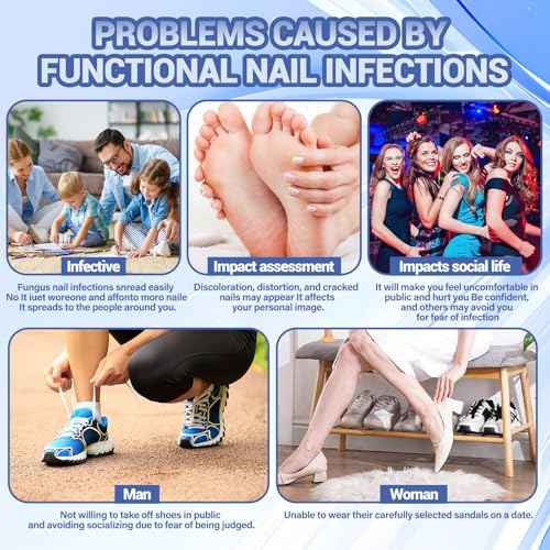 Ingrown Toenail Treatment, 80 Pcs Glue-Free Breathable Corrector Patches, Professional Ingrown Toenail Tools, Not Prone to Falling Off, with File (2 Fl Oz (Pack of 1))